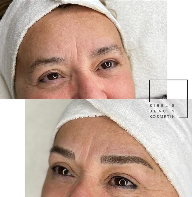PhiMicroblading